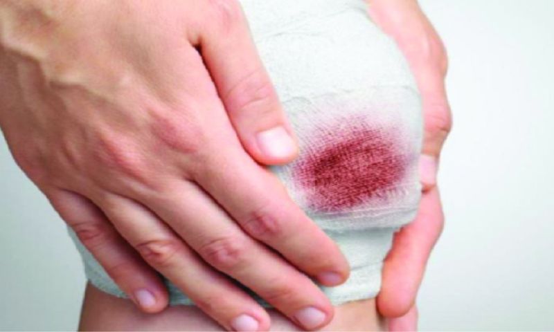 Nguyên nhân gây viêm khớp nhiễm khuẩn