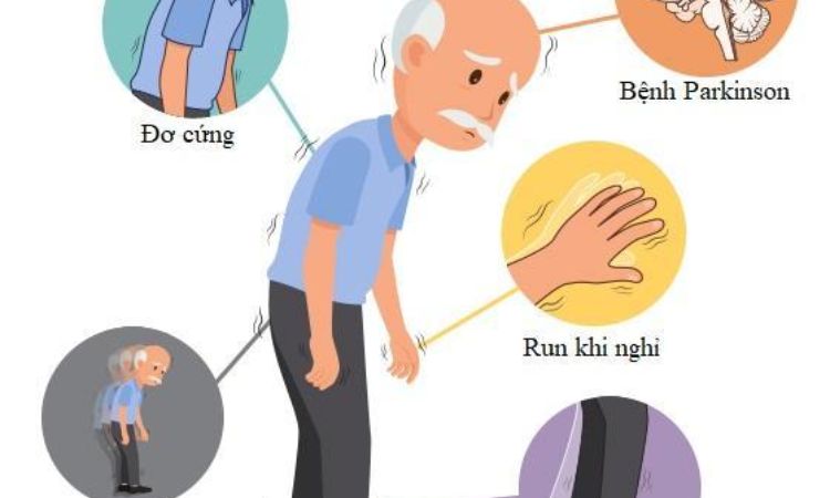 Bệnh Parkinson