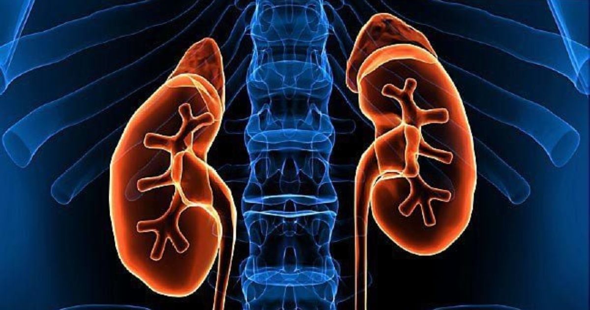 Triệu chứng của hội chứng thận hư