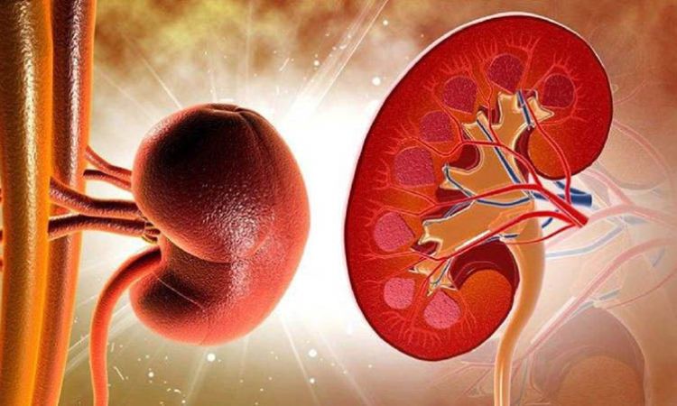 Viêm cầu thận cấp