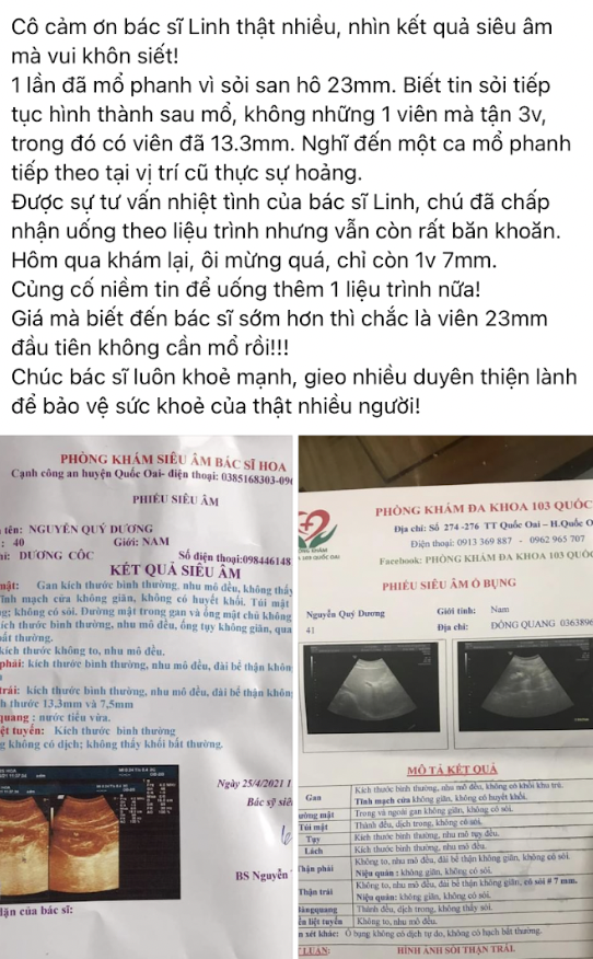 Feedback sỏi thận