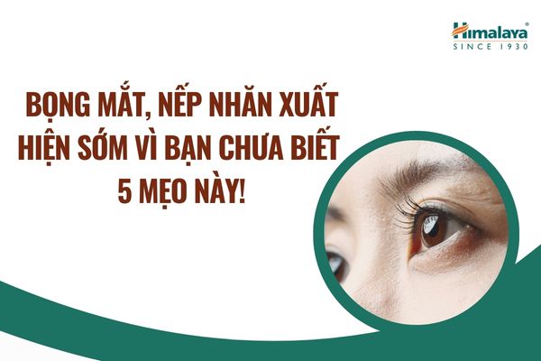 5 mẹo giảm bọng mắt, nếp nhăn xuất hiện sớm