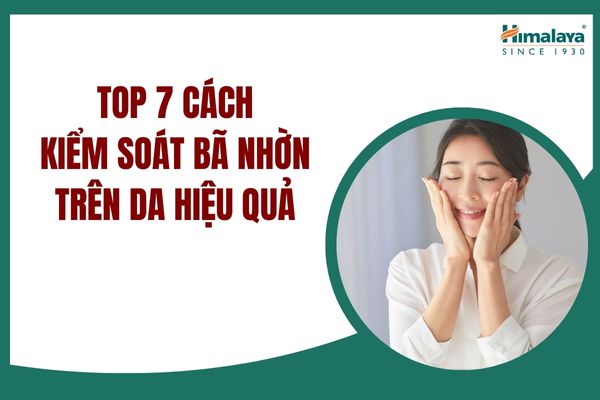 Top 7 cách kiểm soát bã nhờn trên da hiệu quả