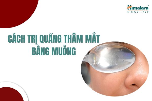 Cách trị quầng thâm mắt bằng muỗng