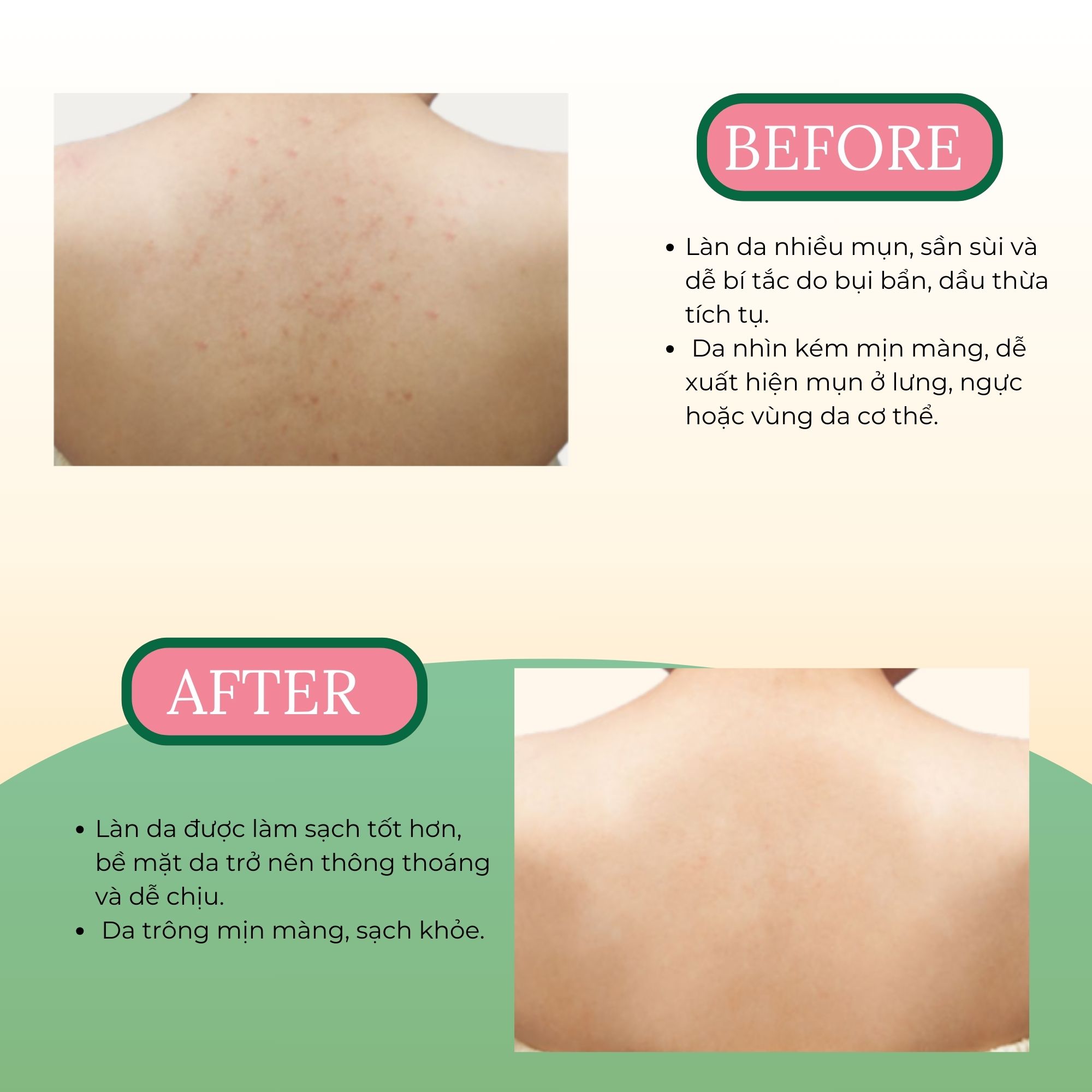 Xà phòng giảm mụn cơ thể từ lá neem Himalaya Neem & Tumeric Soap (1 bánh)