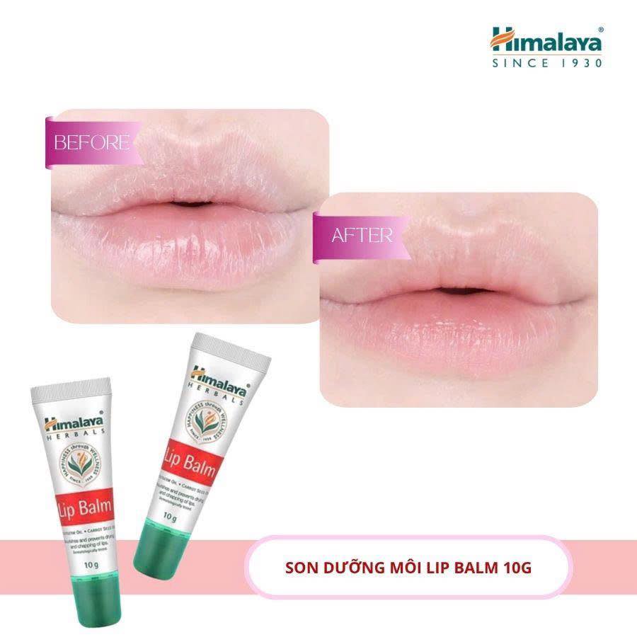 Son Dưỡng Môi Lip Balm 10gm