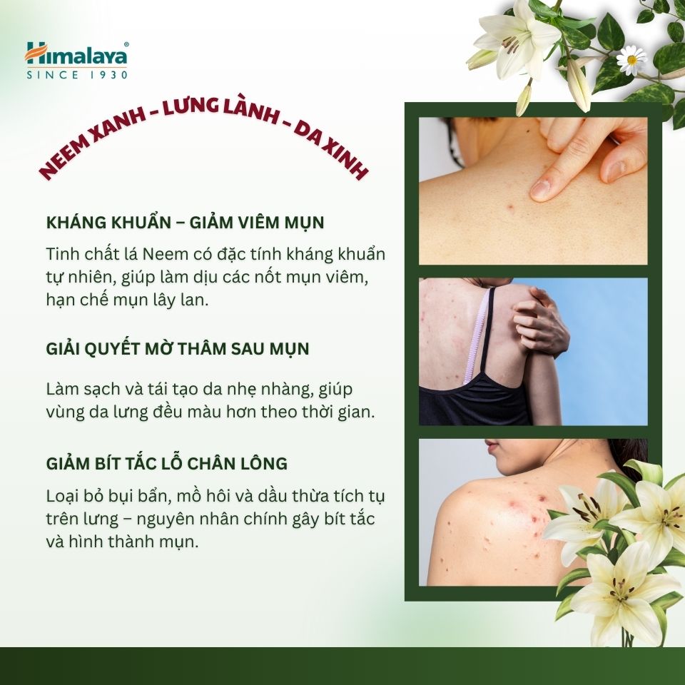 [MUA 3 TẶNG 1] Combo 3 xà phòng giảm mụn cơ thể từ lá neem Himalaya Neem & Tumeric Soap (3 BÁNH+ 1))