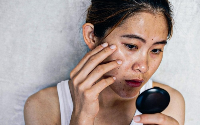 Da bị xỉn màu đôi khi không phải đến từ góc độ thẩm mỹ.@internet