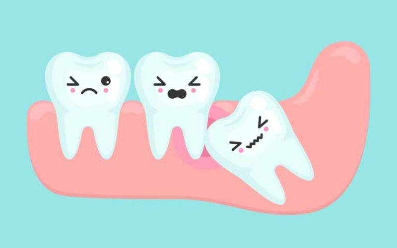 Sau từ 48 đến 72 giờ đầu sau khi nhổ răng khôn, bệnh nhân nên chú ý thật kỹ các thực phẩm của mình để tránh ảnh hưởng đến sức khỏe.@internet