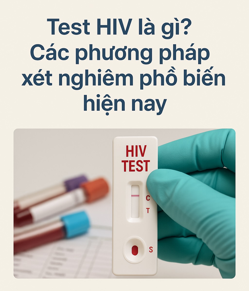 Test HIV là gì? Các phương pháp xét nghiệm phổ biến hiện nay