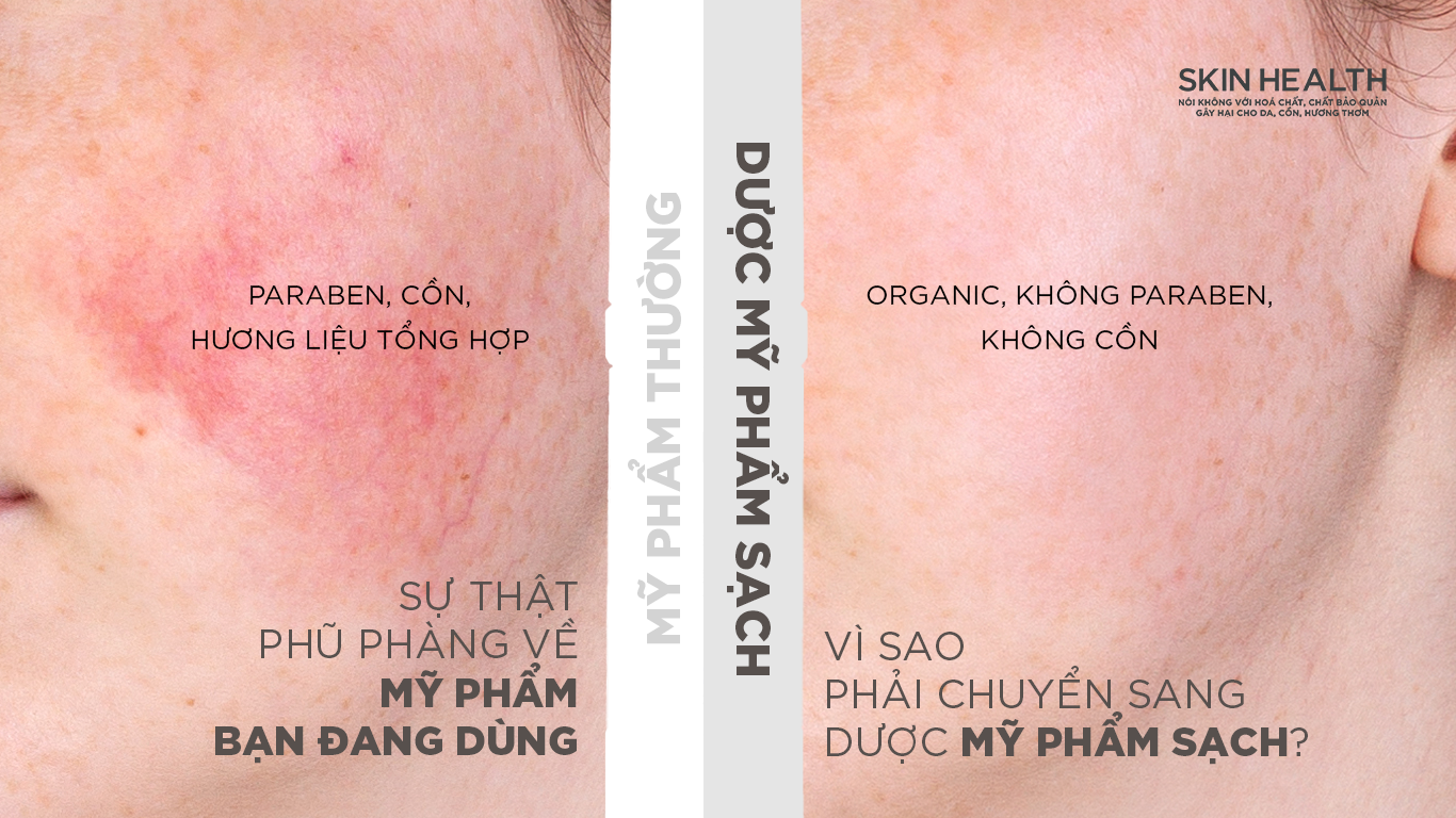 Sự Thật Phũ Phàng Về Mỹ Phẩm Bạn Đang Dùng: Vì Sao Phải Chuyển Sang Dược Mỹ Phẩm Sạch?