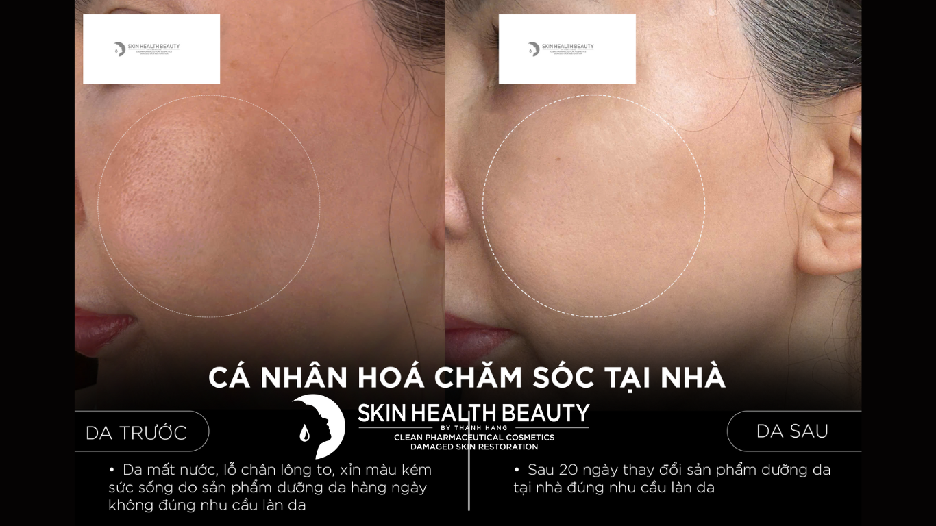 CÁ NHÂN HOÁ CHĂM SÓC DA TẠI NHÀ