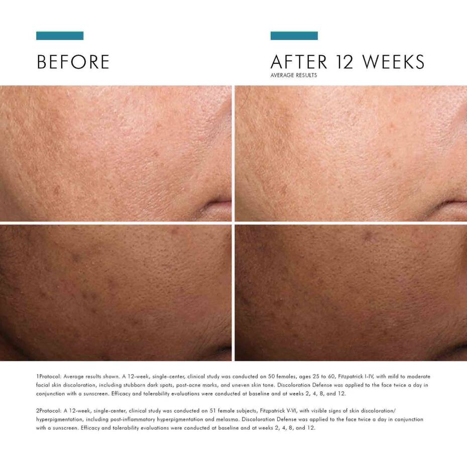 SKINCEUTICALS DISCOLORATION DEFENSE/ SERUM MỜ THÂM NÁM VÀ LÀM SÁNG ĐỀU MÀU DA