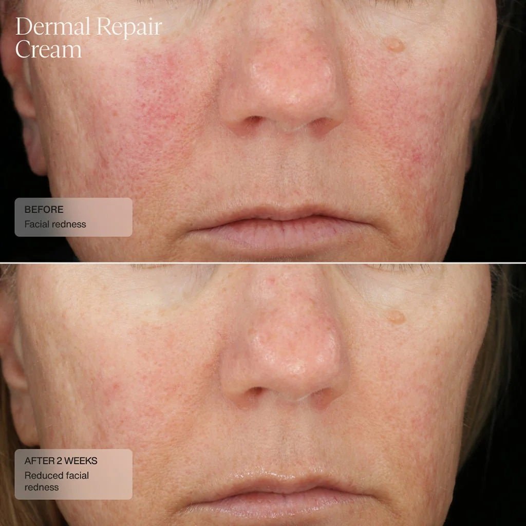 SANTÉ DERMAL REPAIR CREAM/ KEM DƯỠNG PHỤC HỒI VÀ NUÔI DƯỠNG LÀN DA