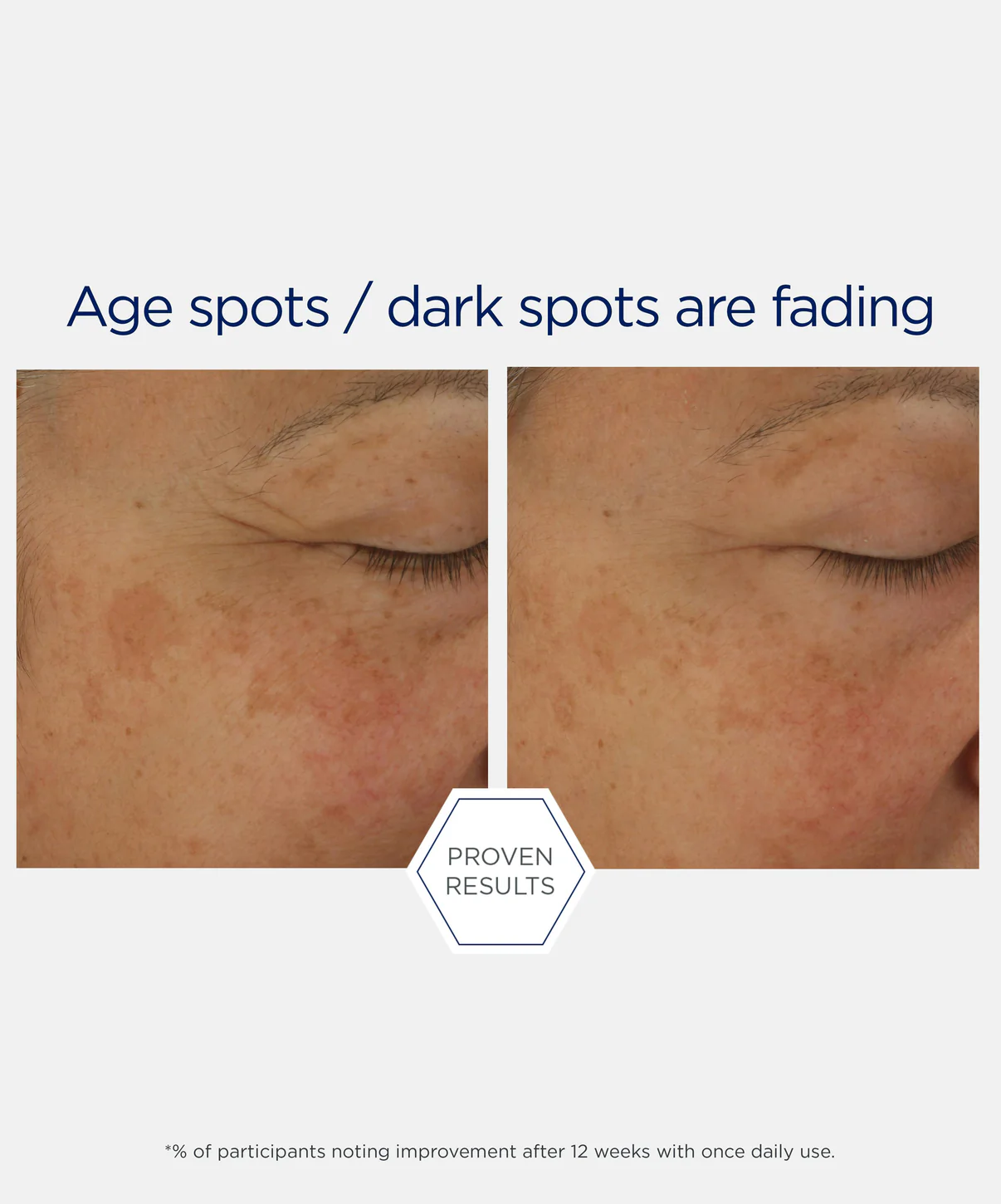 NEOSTRATA POTENT RETINOL COMPLEX/ KEM DƯỠNG ĐA NĂNG TRỊ MỤN- TRẺ HOÁ- MỜ THÂM NÁM