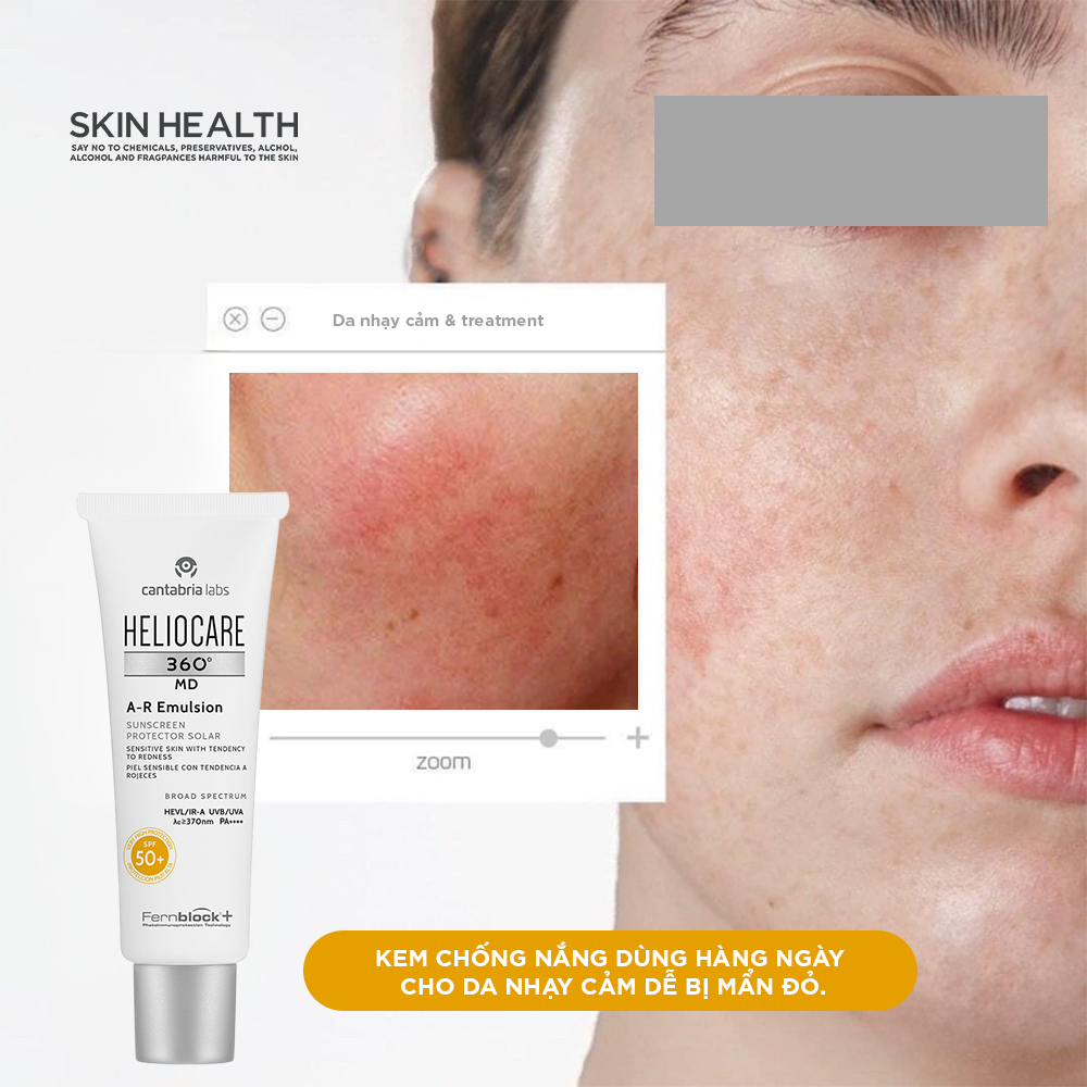HELIOCARE A-R EMULSION SPF50+: Kem Chống Nắng Lý Tưởng Cho Da Nhạy Cảm, Dễ Bị Mẩn Đỏ