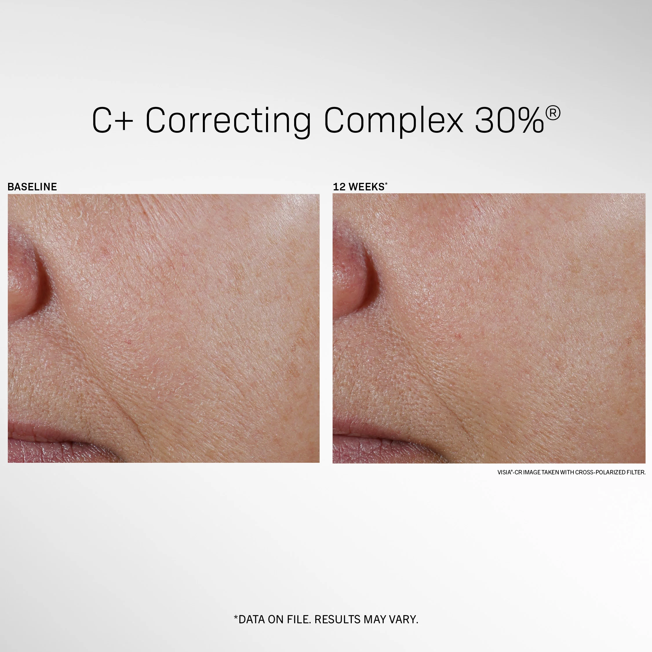 REVISION SKINCARE C+ Correcting Complex 30%- SERUM LÀM SÁNG, GIẢM NÁM, TRẺ HOÁ DA
