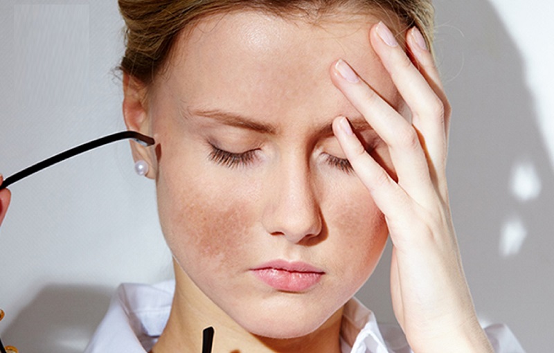 Skin care tips for melasma