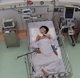 Bé trai ngủ trên sàn nhà bị rắn độc cắn nguy kịch