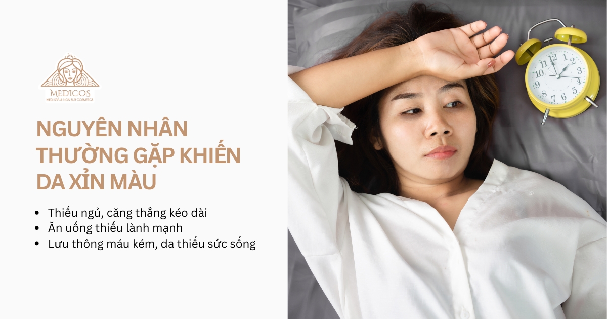 Nguyên nhân da xỉn màu do thiếu ngủ và stress