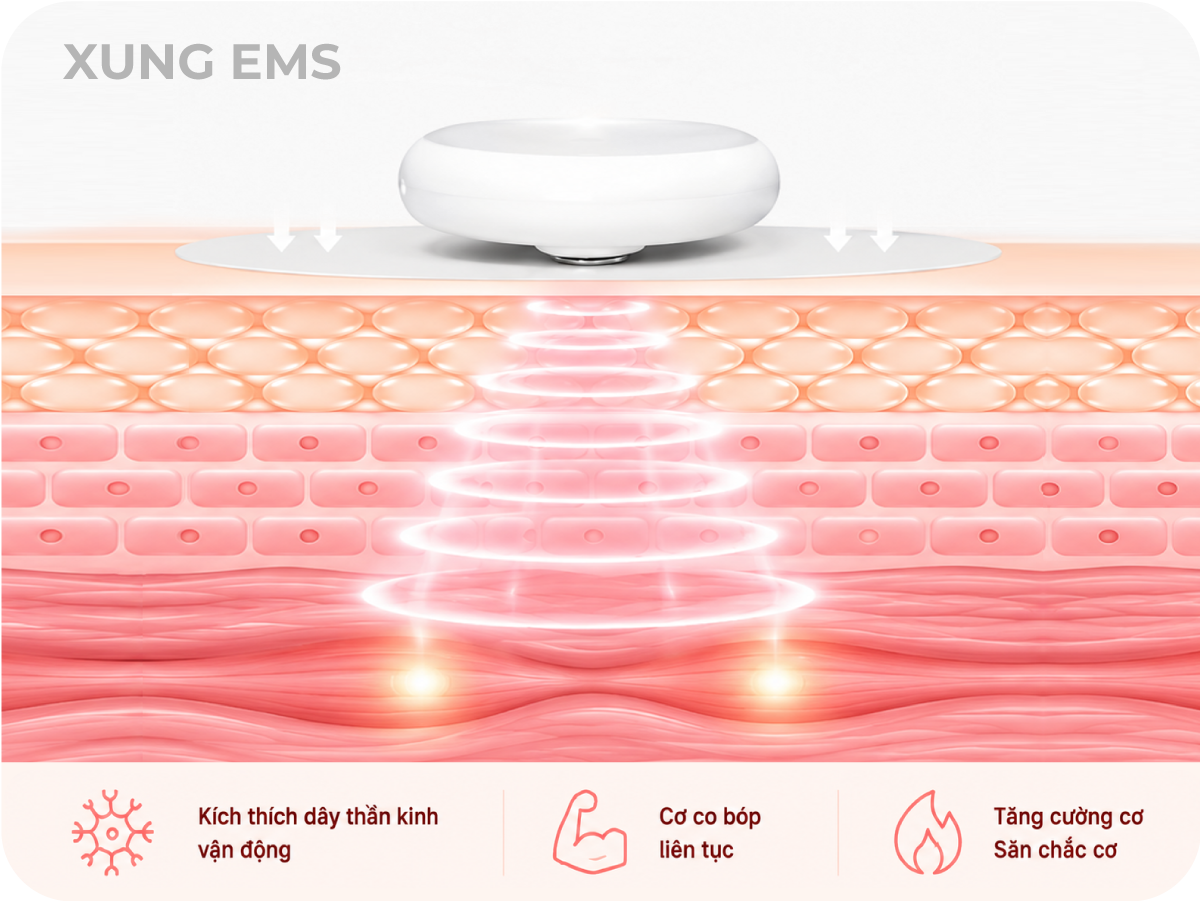 UHUB EMS Technology