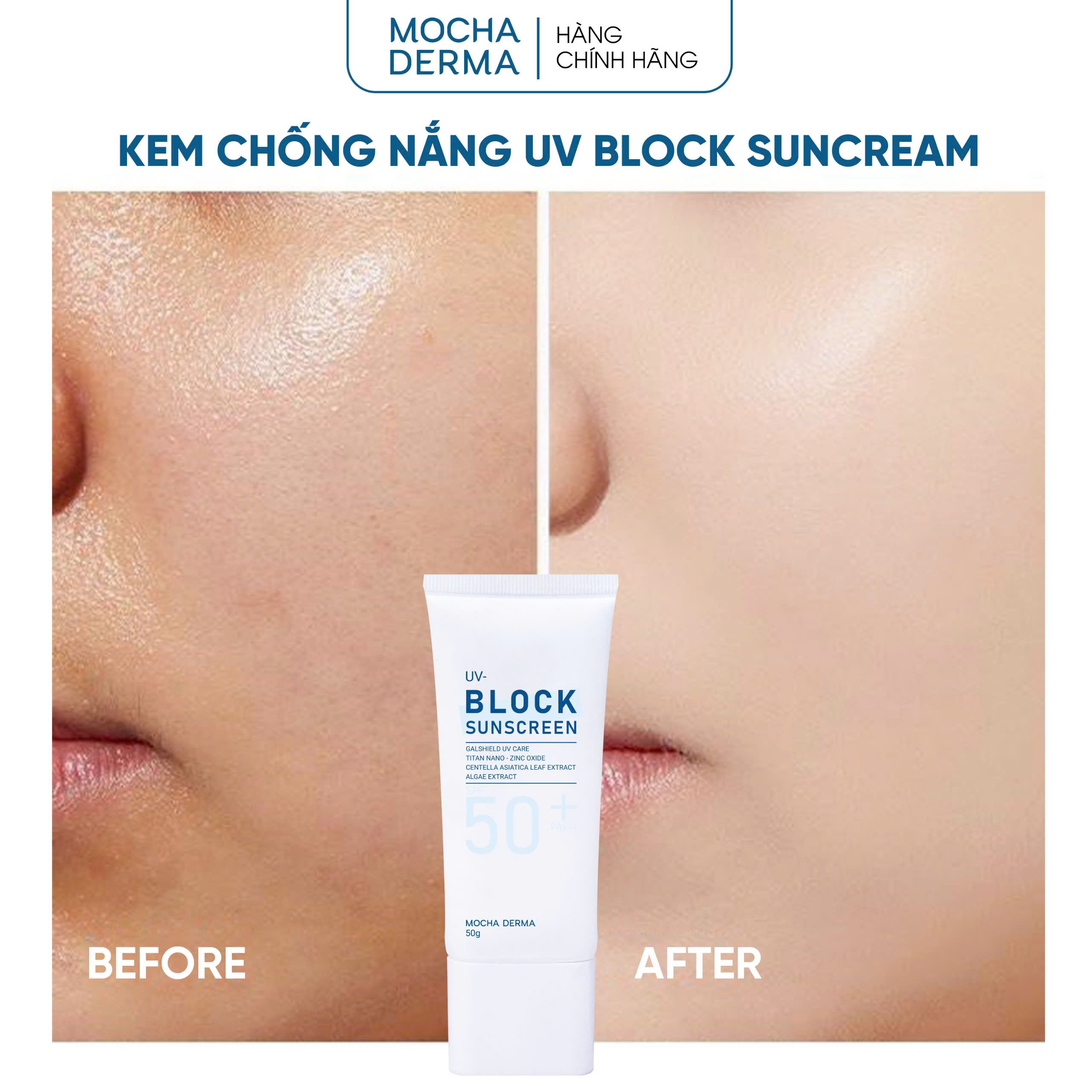 Kem chống nắng lý hóa 7 màng lọc  UV – BLOCK SUNSCREEN