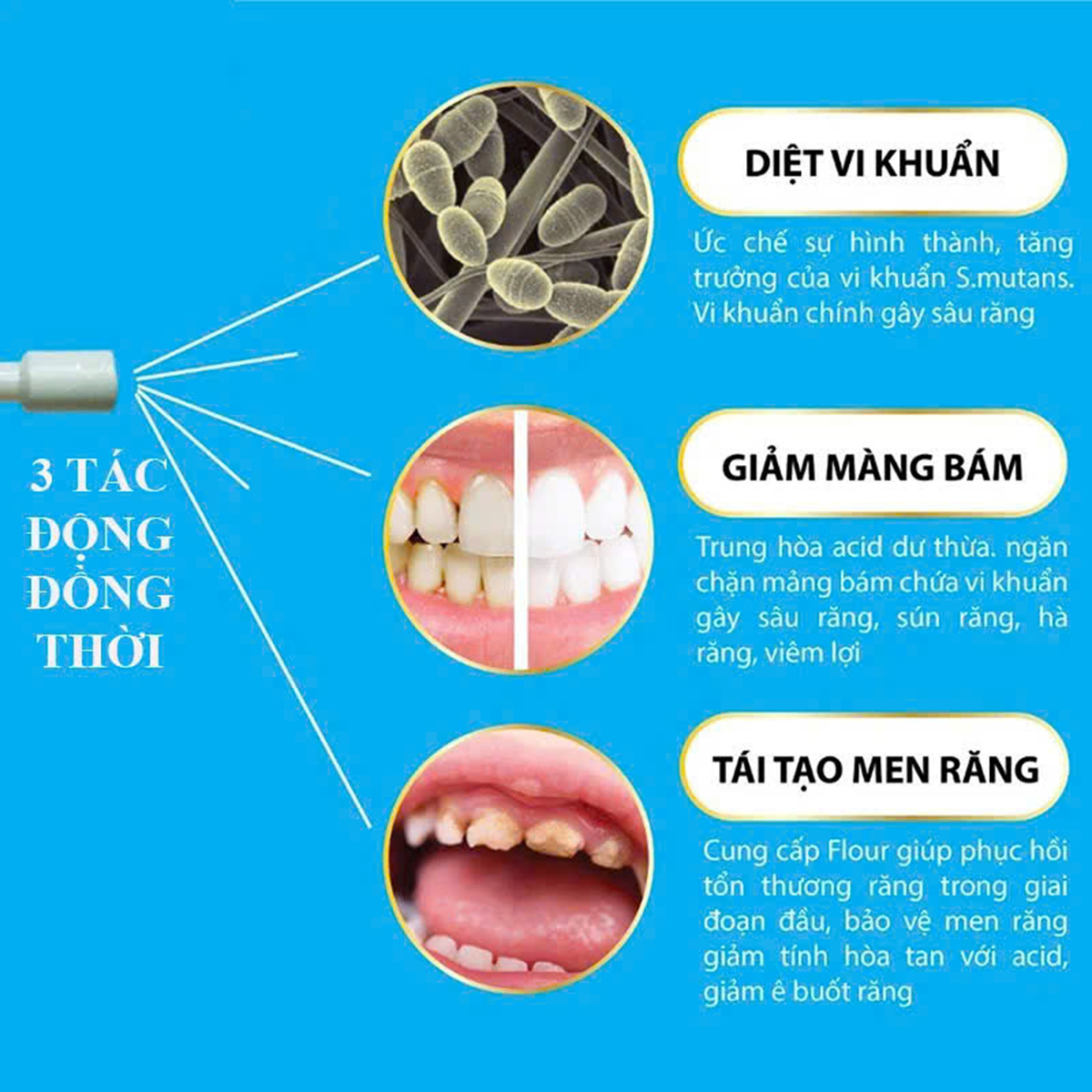 Xịt sâu răng Midkid 30ml