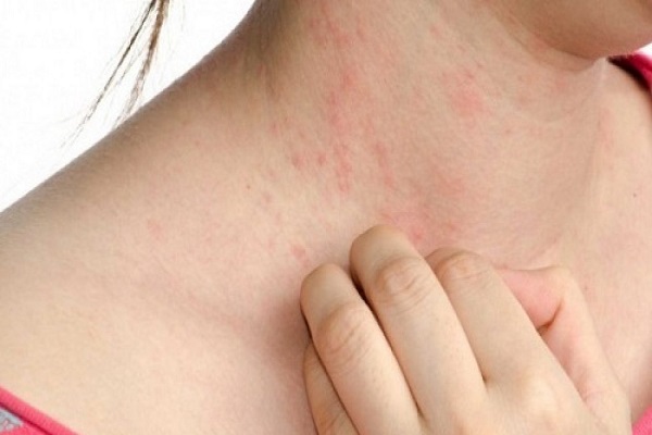 Chăm Sóc Da Mùa Hè Trong Khí Hậu Nhiệt Đới Việt Nam: Bí Quyết Chống Chọi Với Nắng Nóng Và Ô Nhiễm