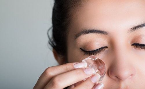 Trị mụn bằng đá lạnh có tốt không?