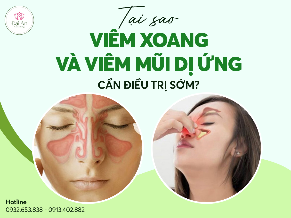 Tại Sao Viêm Xoang Và Viêm Mũi Dị Ứng Cần Điều Trị Sớm?