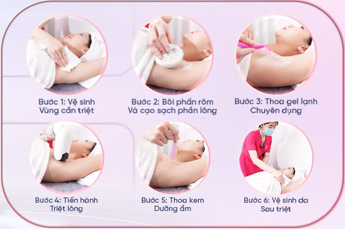 Quy trình triệt Lông tại Dưỡng Tâm An Spa