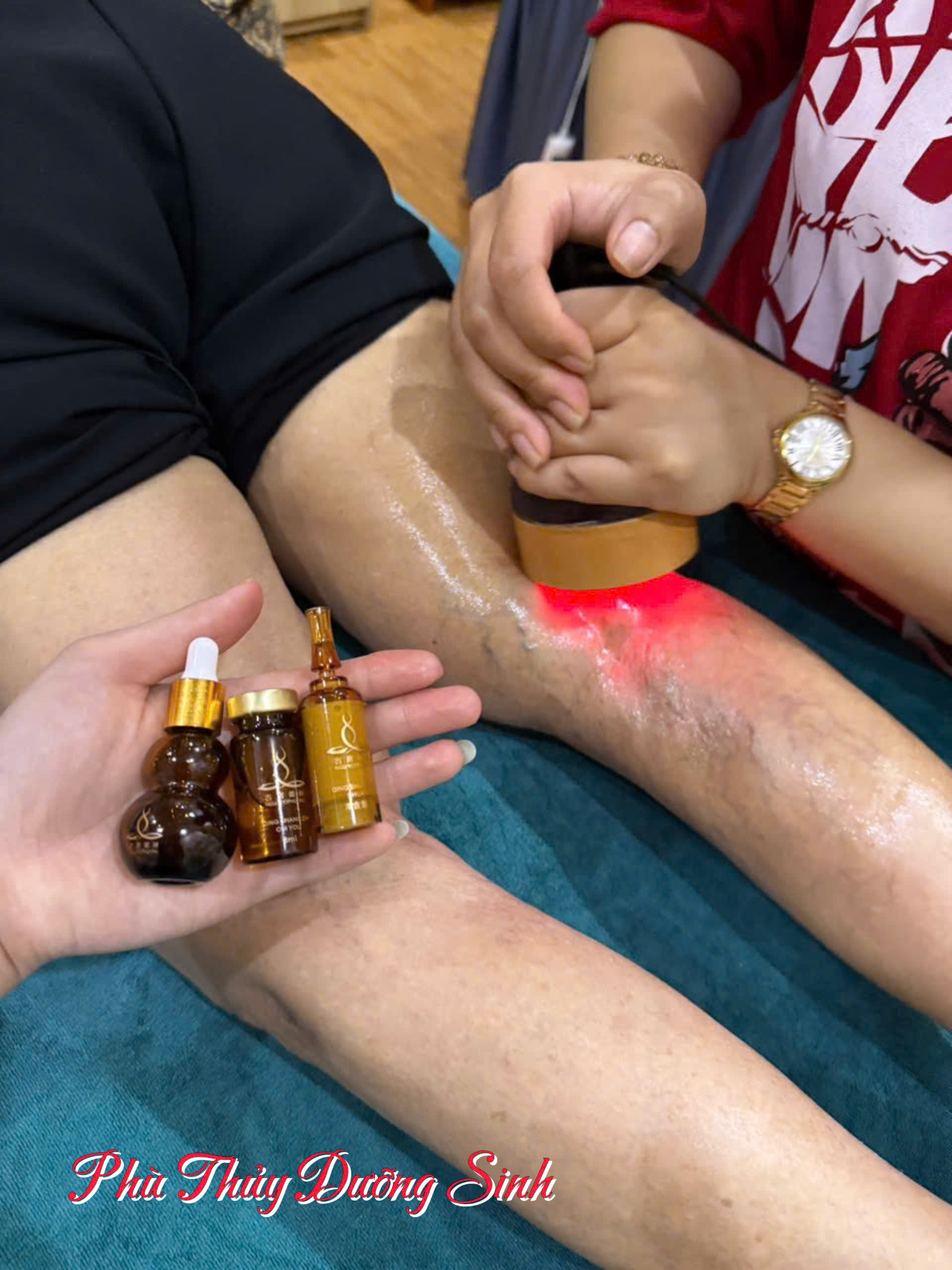 Giãn Mao Mạch Ở Chân – Nguyên Nhân, Dấu Hiệu &amp; Giải Pháp Tại Dưỡng Tâm An Spa