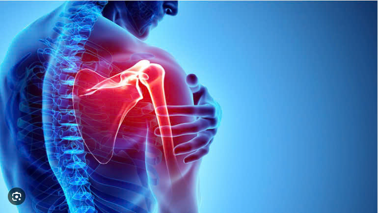 Chữa đau vai gáy - Cánh tay bằng Điện sinh học DDS