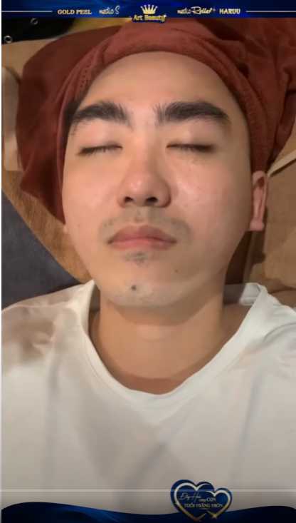 Anh trai bị Mụn mạch lươn