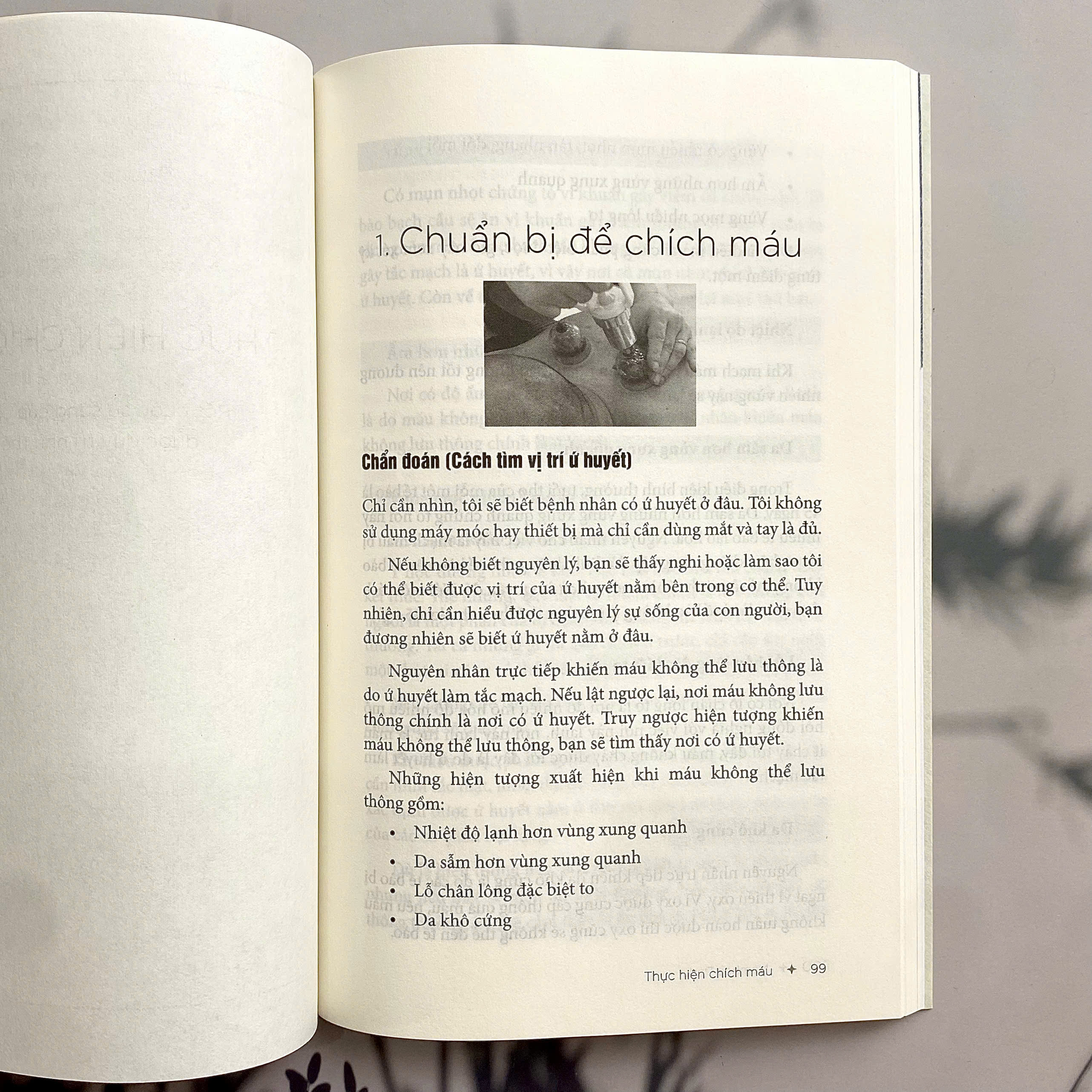 Sách - Liệu pháp giác hơi chích máu Simcheon 1
