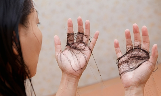 8 thực phẩm giàu biotin chuyên gia khuyên dùng để giảm rụng tóc