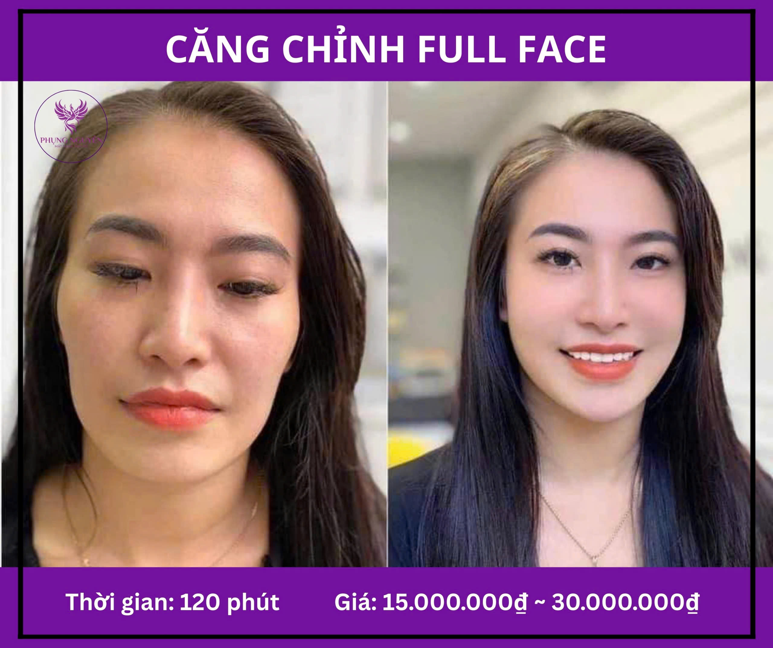 CĂN CHỈNH FULLFACE