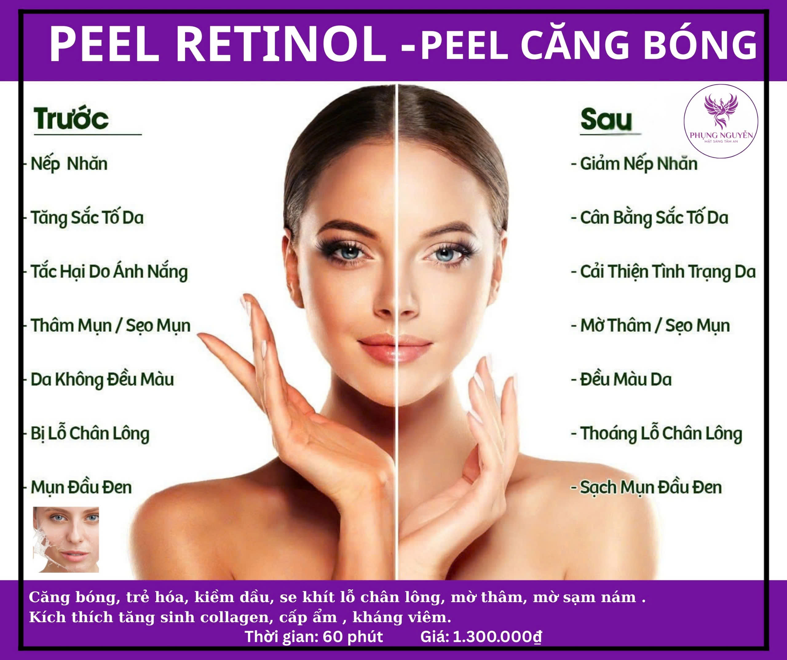 PEEL RETINOL<br>PEEL CĂNG BÓNG
