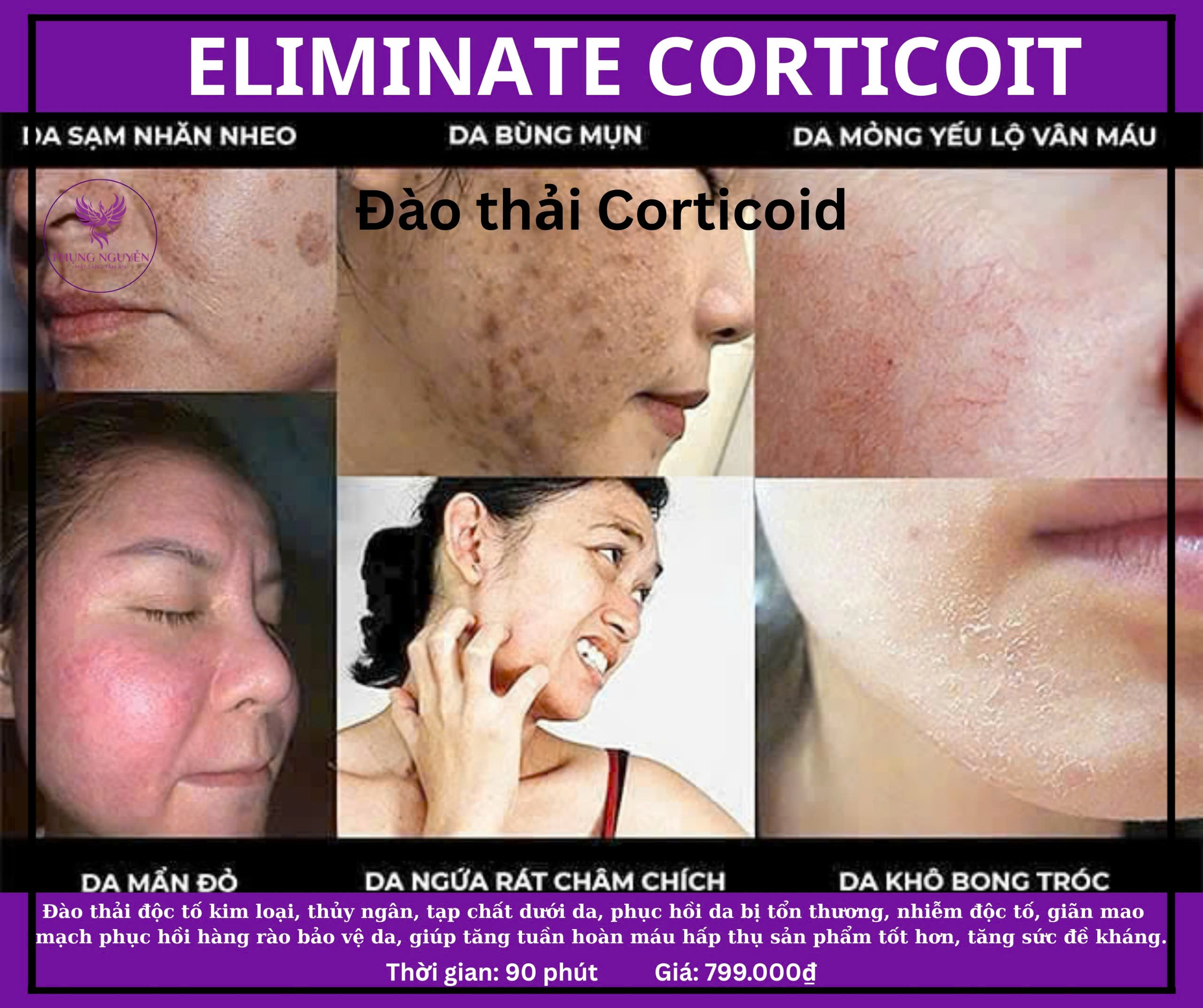 EMILIATE CORTICOIT