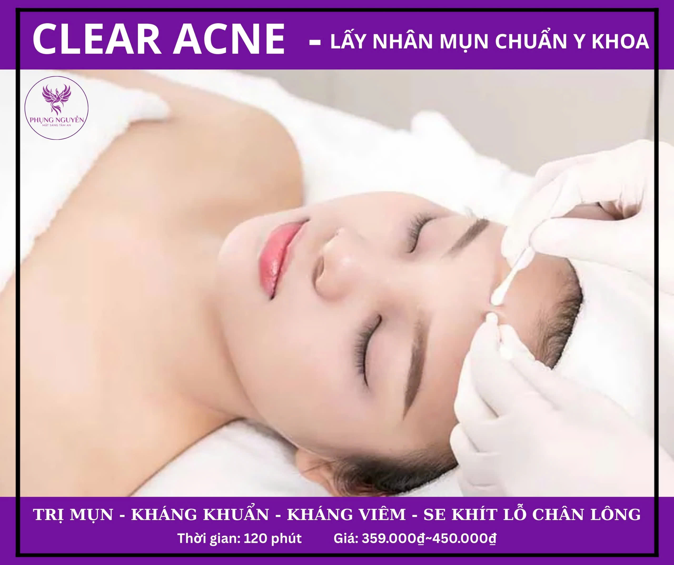 CLEAN ACNE<br>LẤY NHÂN MỤN CHUẨN Y KHOA
