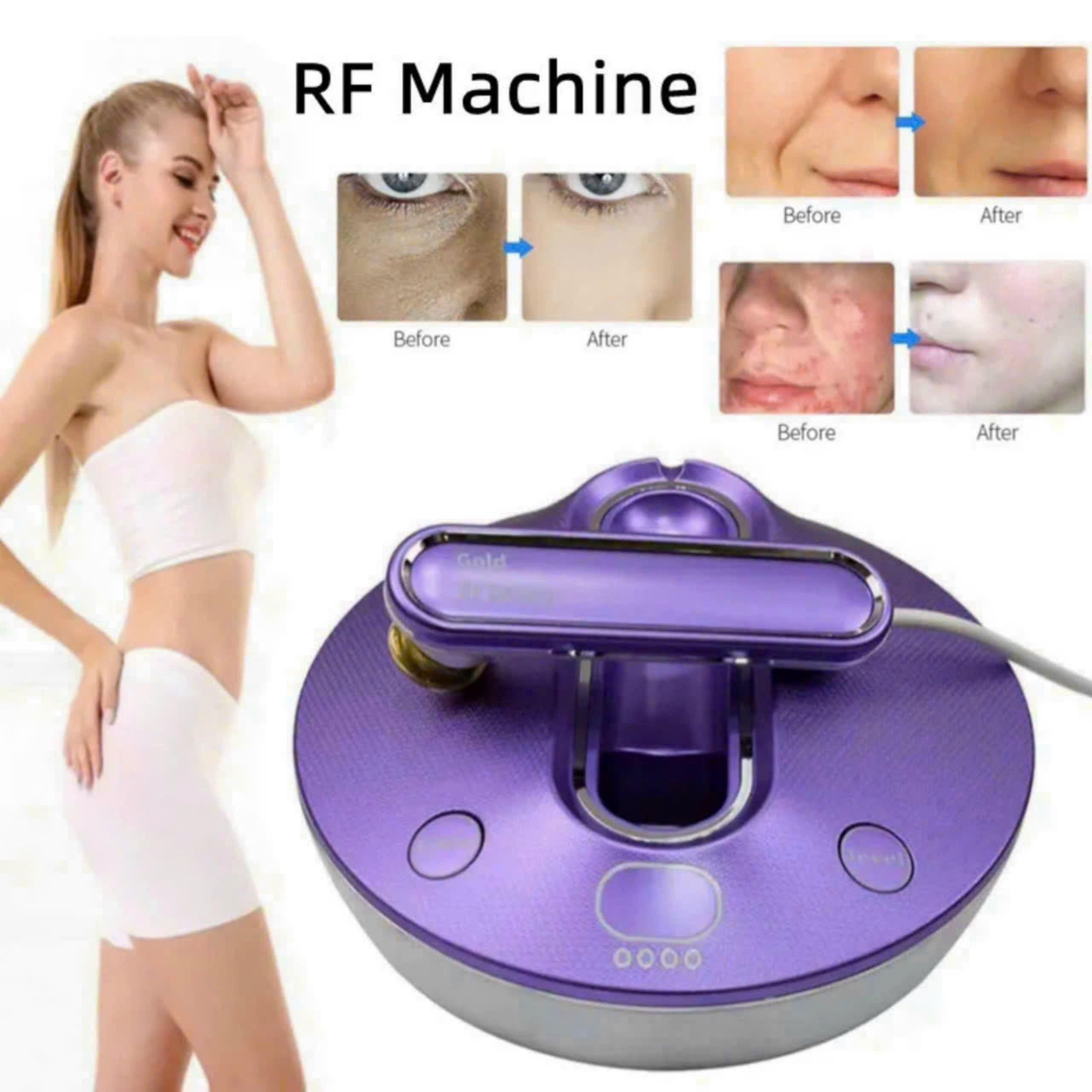 Máy xóa nhăn Gold RF Beauty