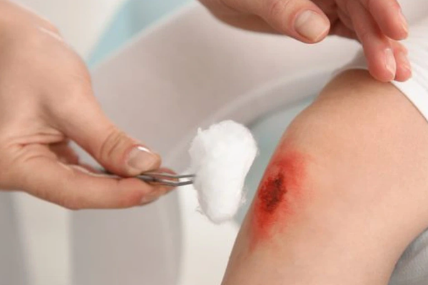 Khi có vết thương hở hoặc các vấn đề về da