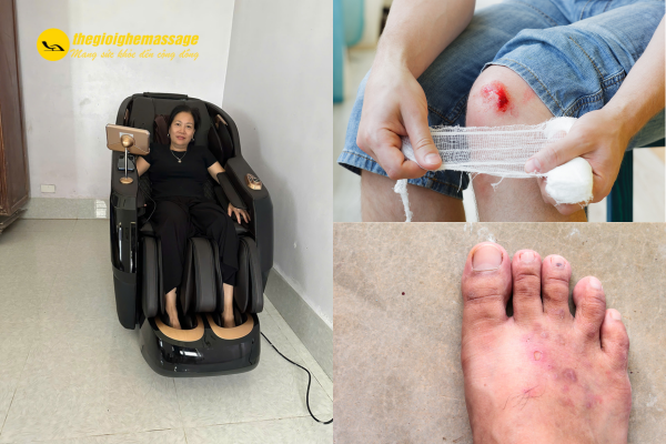 Không dùng ghế massage khi đang mắc bệnh ngoài da