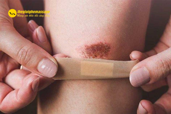 Không Dùng Sonic Wave Trên Vết Thương Hở