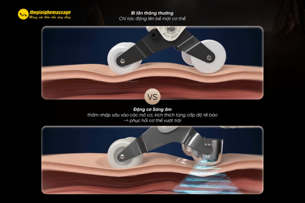 Sonic Wave Có Tốt Hơn Công Nghệ Thường Không?