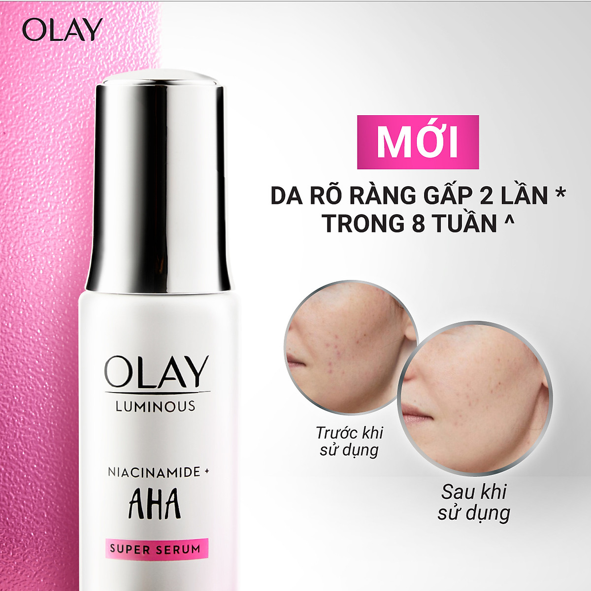 OLAY Luminous Kem Dưỡng Da Serum Niacinamide, Niacinamide + AHA Dưỡng Trắng Da Ngừa Thâm Nám 30g/50g
