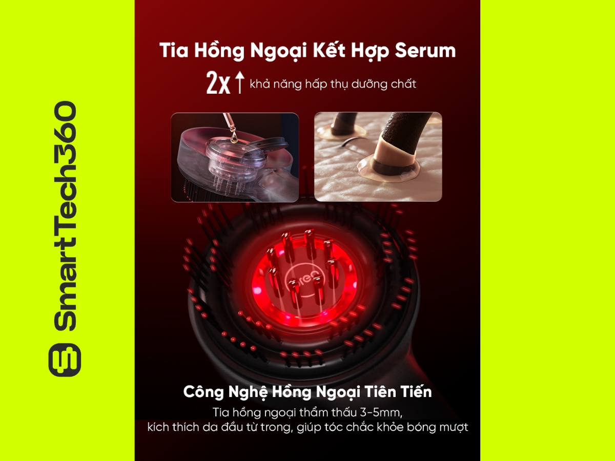 luoc dien breo scalp 3 tia hong ngoai