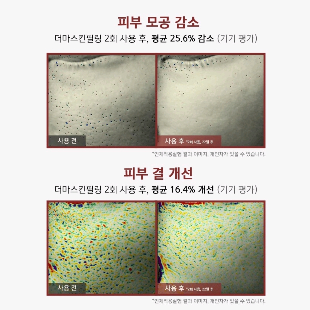 DERMA SKIN PEEL BQCELL - TÁI TẠO DA