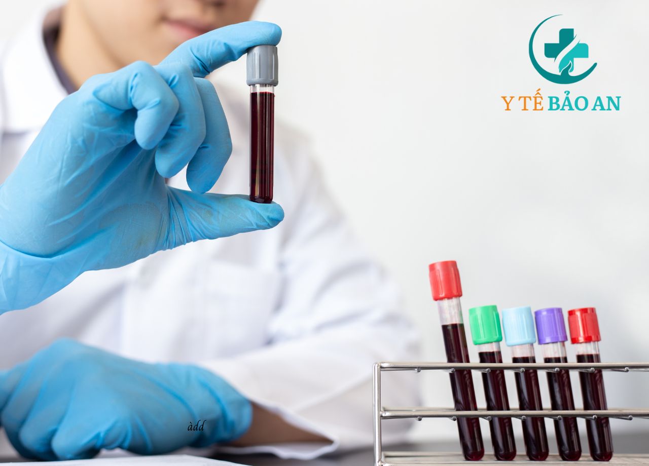 Lấy máu xét nghiệm 