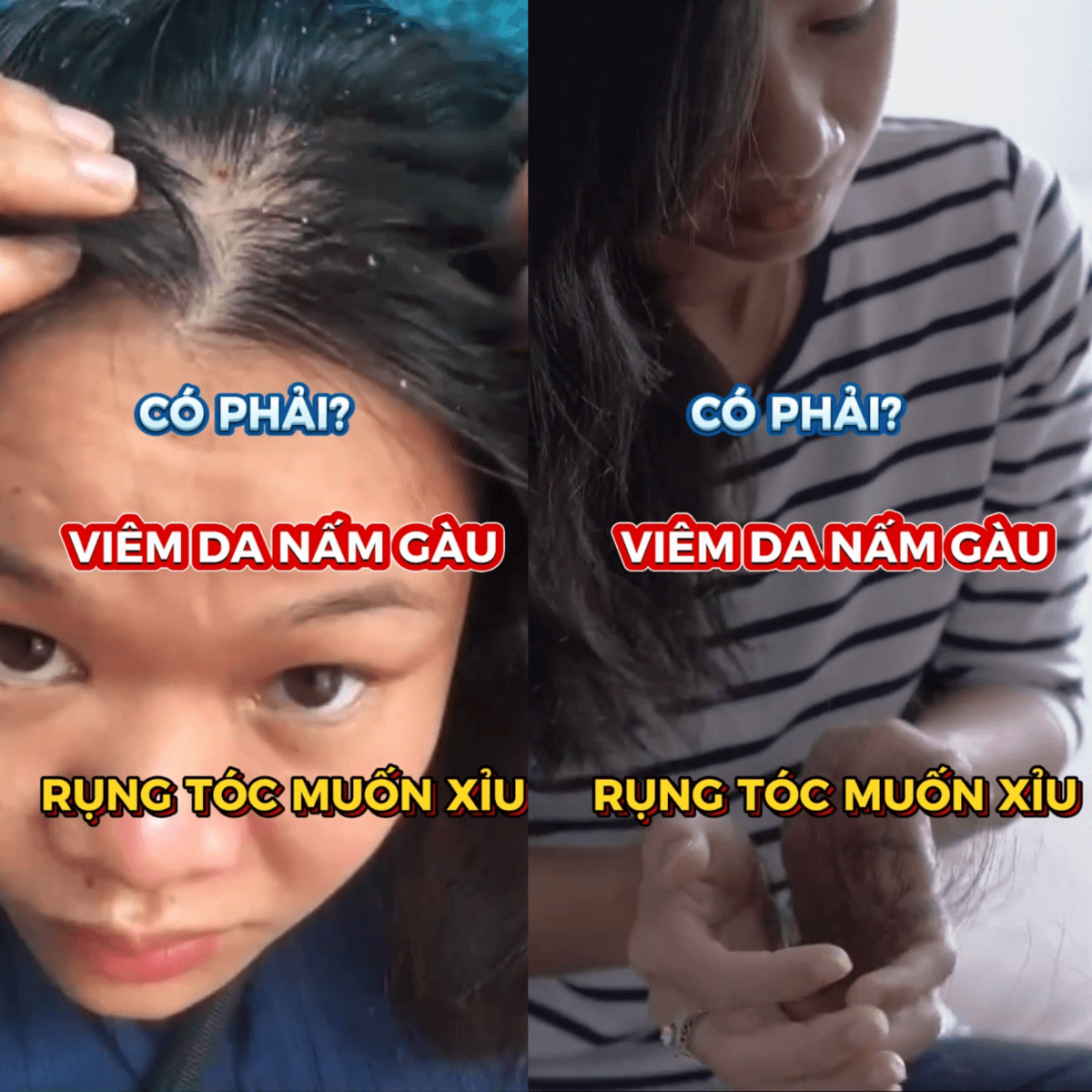 Kem Bôi Canova Rivescal DS 50ml – Giảm Viêm Da Tiết Bã, Ngăn Ngừa Nấm Ngứa, Làm Dịu Da